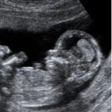 cagnotte naissance
