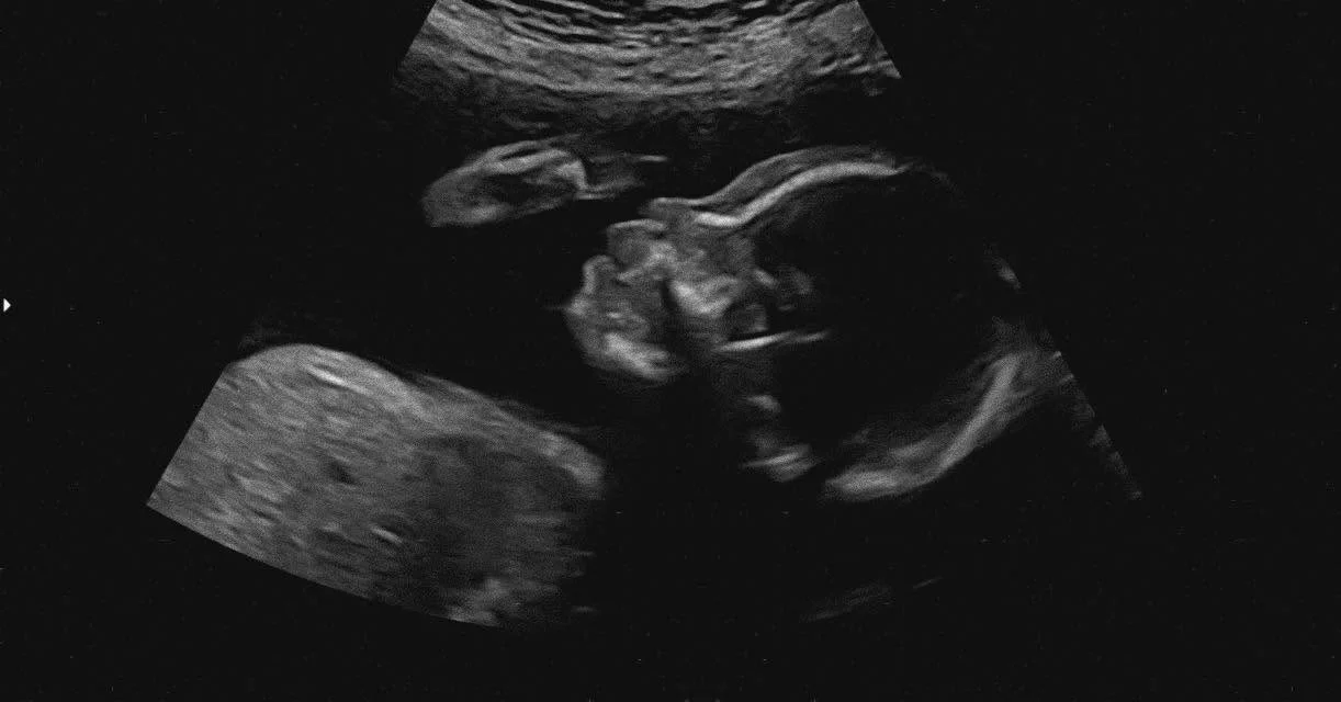 cagnotte naissance