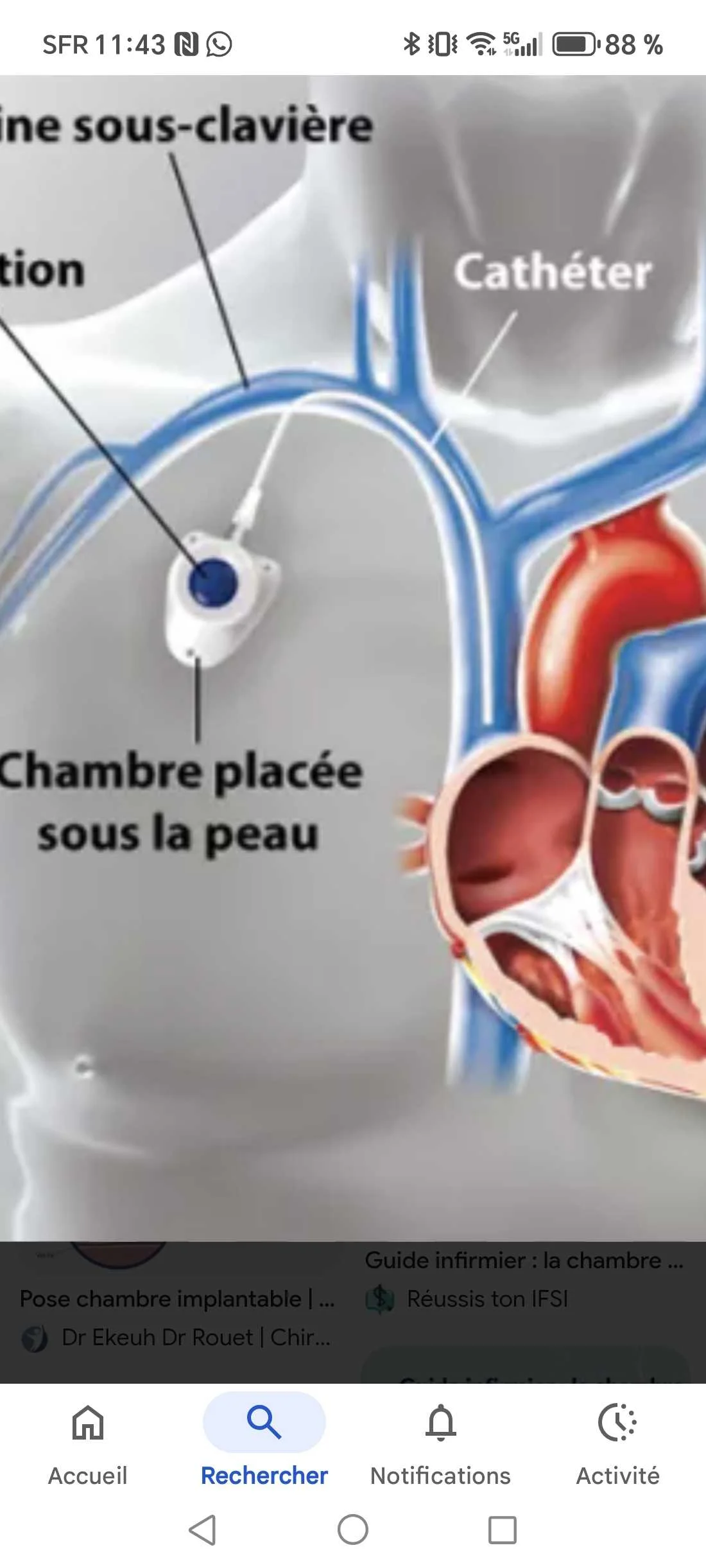cagnotte solidarité