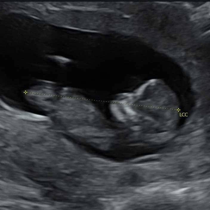 cagnotte naissance