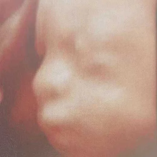 cagnotte naissance