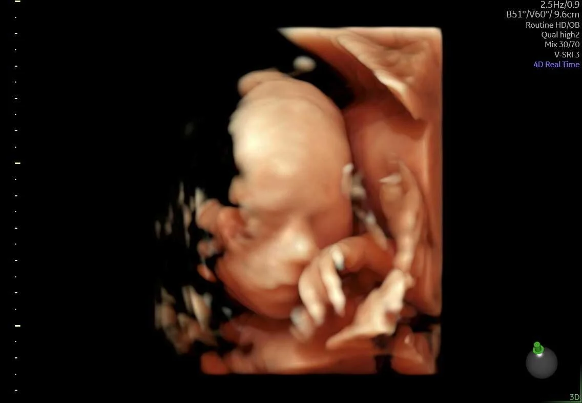 cagnotte naissance
