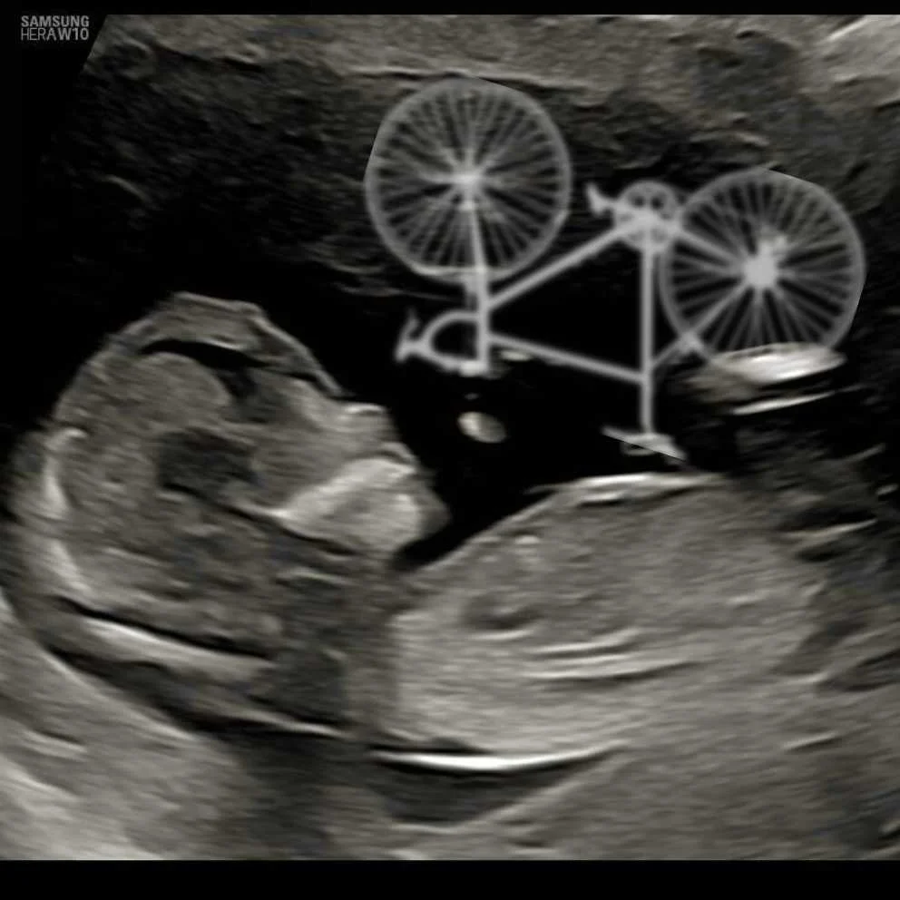 cagnotte naissance