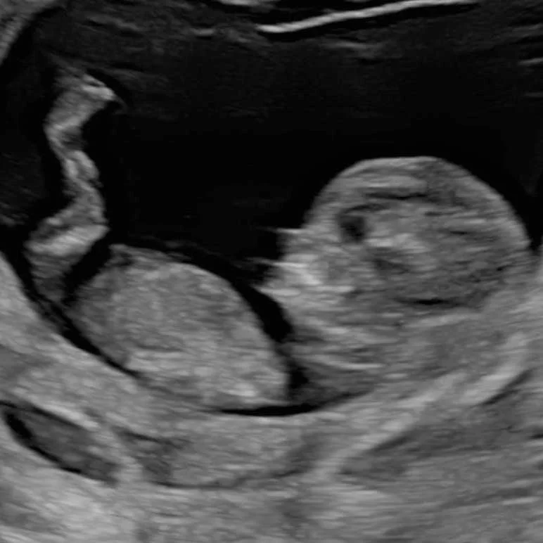 cagnotte naissance