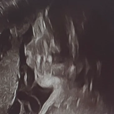 cagnotte naissance