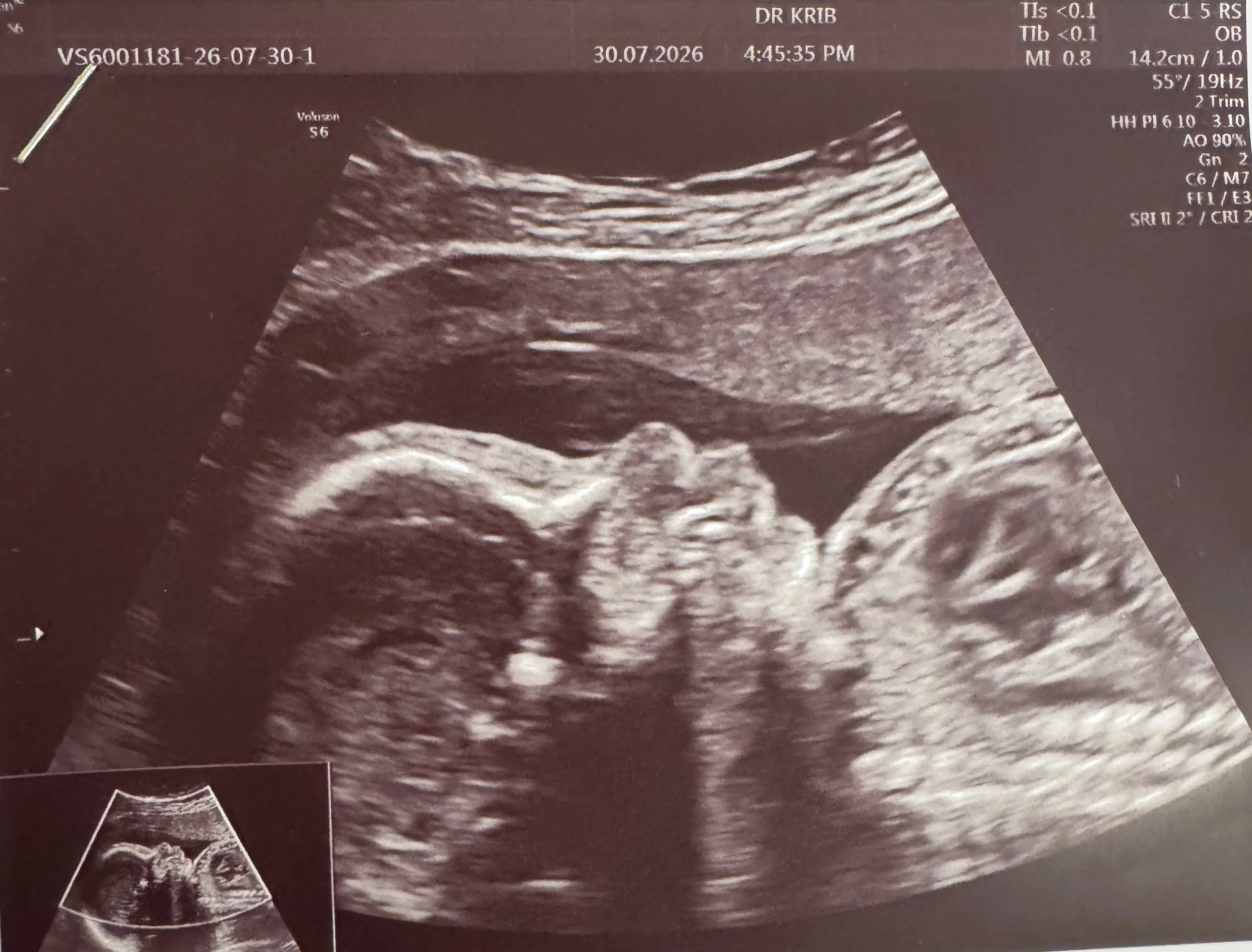 cagnotte naissance