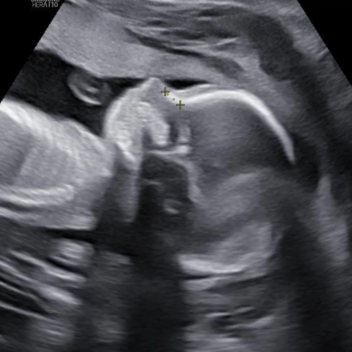 cagnotte naissance