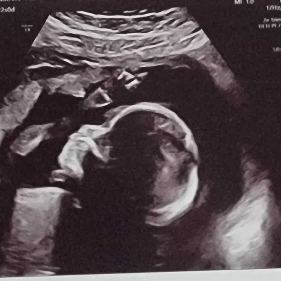 cagnotte naissance