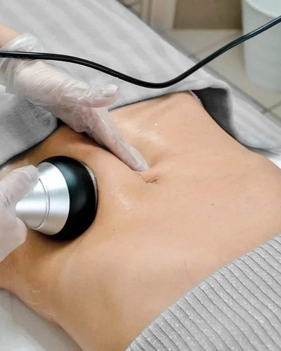 Séance de lipocavitation 