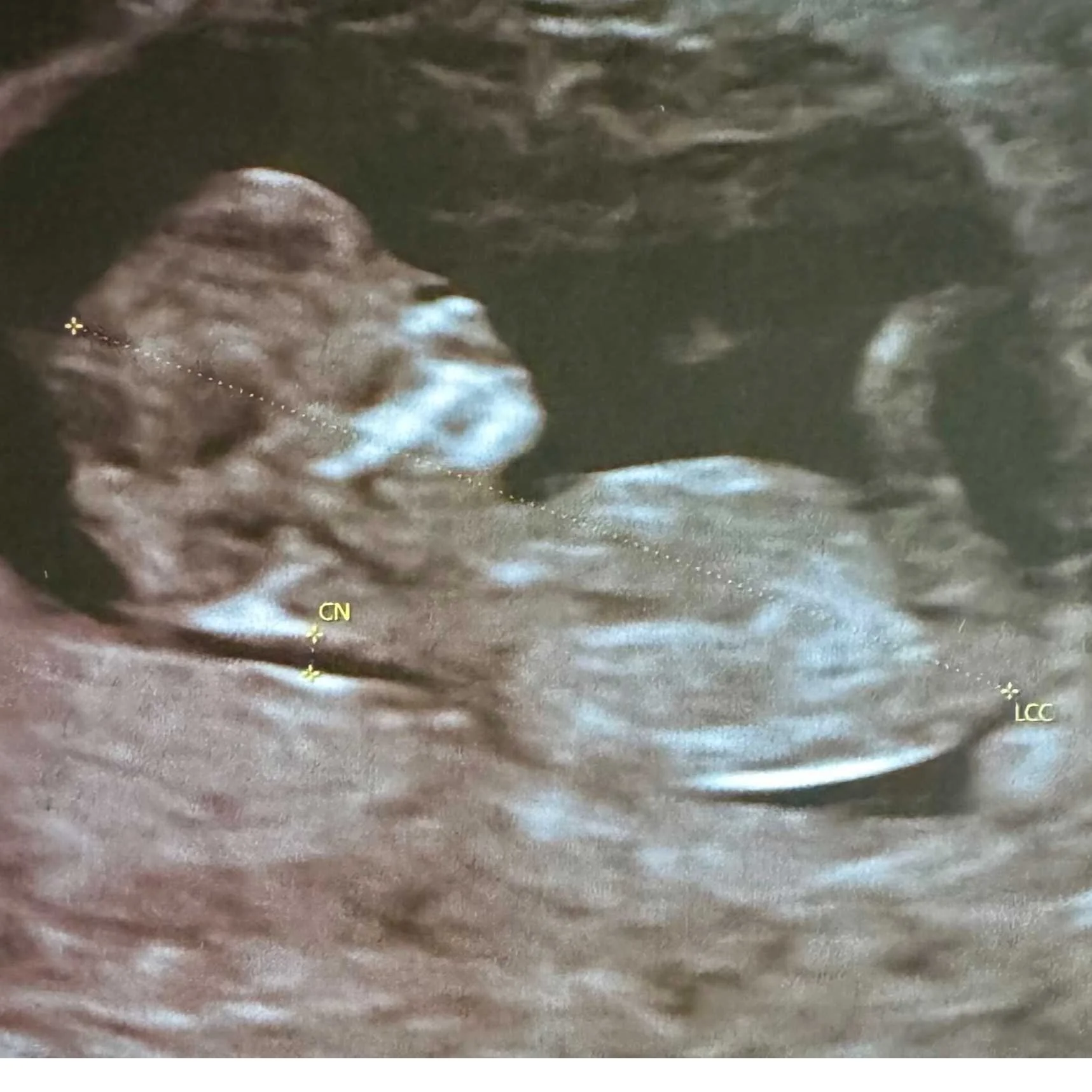 cagnotte naissance