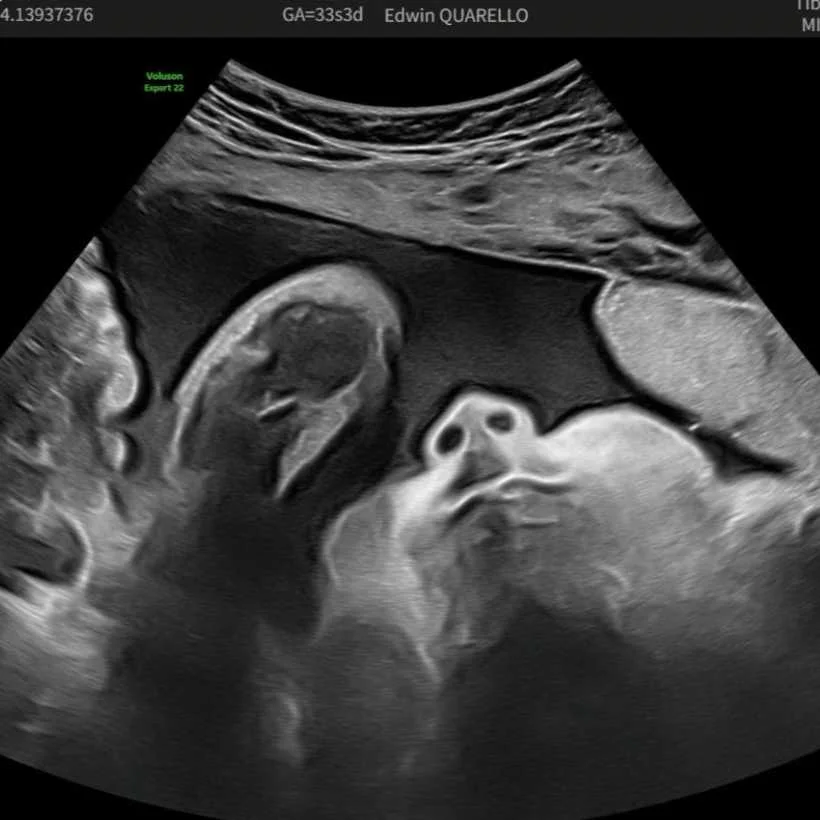 cagnotte naissance
