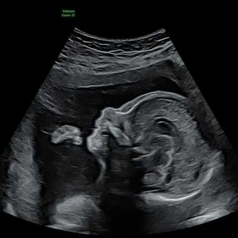 cagnotte naissance