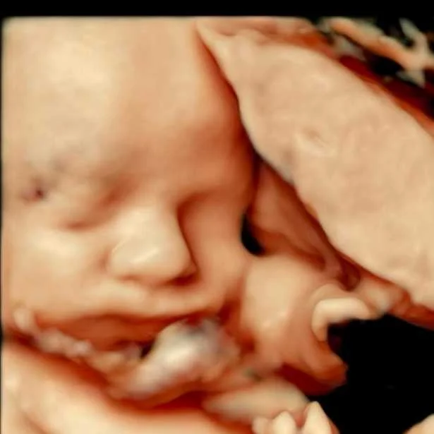 cagnotte naissance