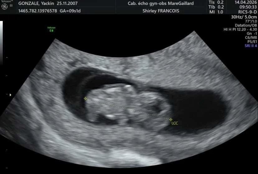 cagnotte naissance