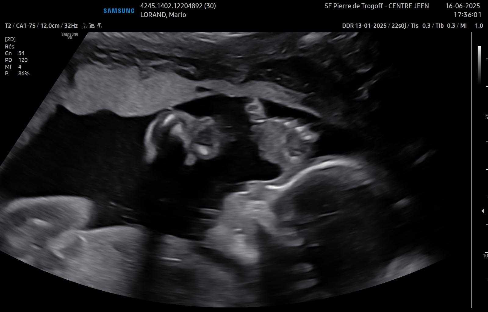 cagnotte naissance