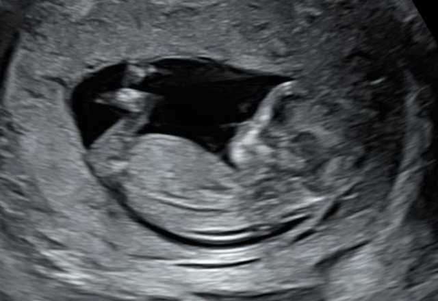 cagnotte naissance