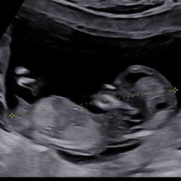 cagnotte naissance
