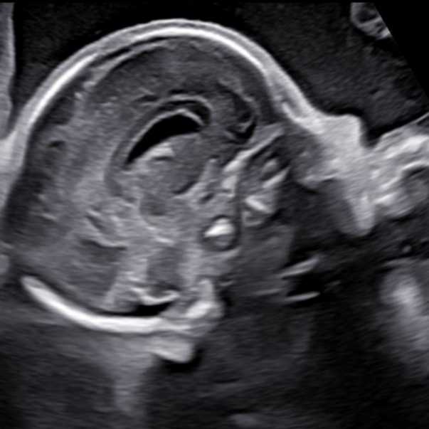 cagnotte naissance